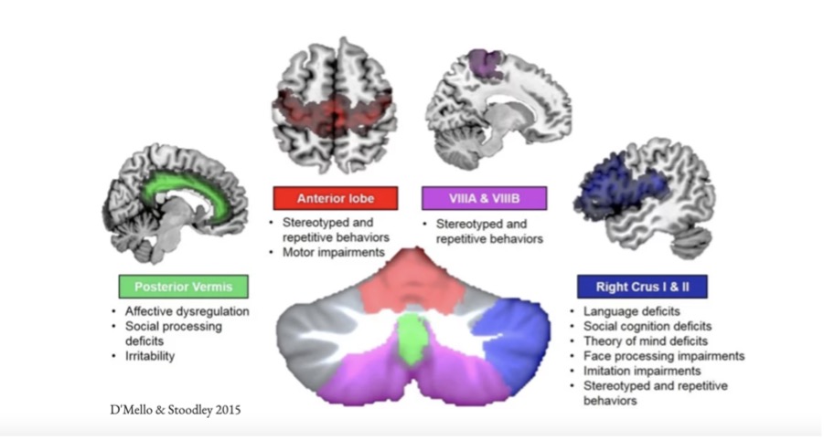The different parts of the brain