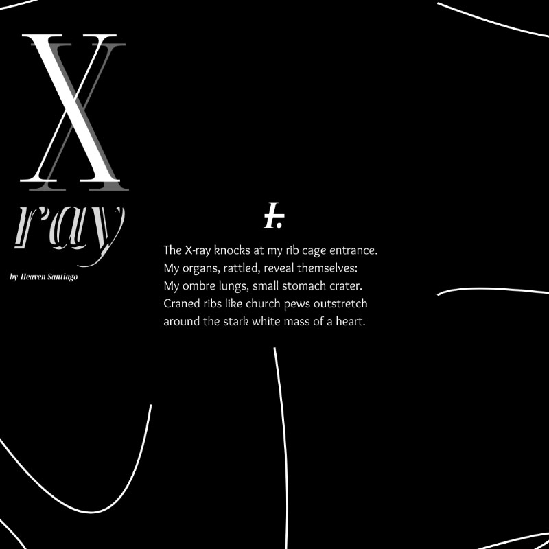 X ray by Heaven Santiago. I. The X-ray knocks at my rib cage entrance. My organs, rattled, reveal themselves: My ombre lungs, small stomach crater. Craned ribs like church pews outstretch around the stark white mass of a heart.